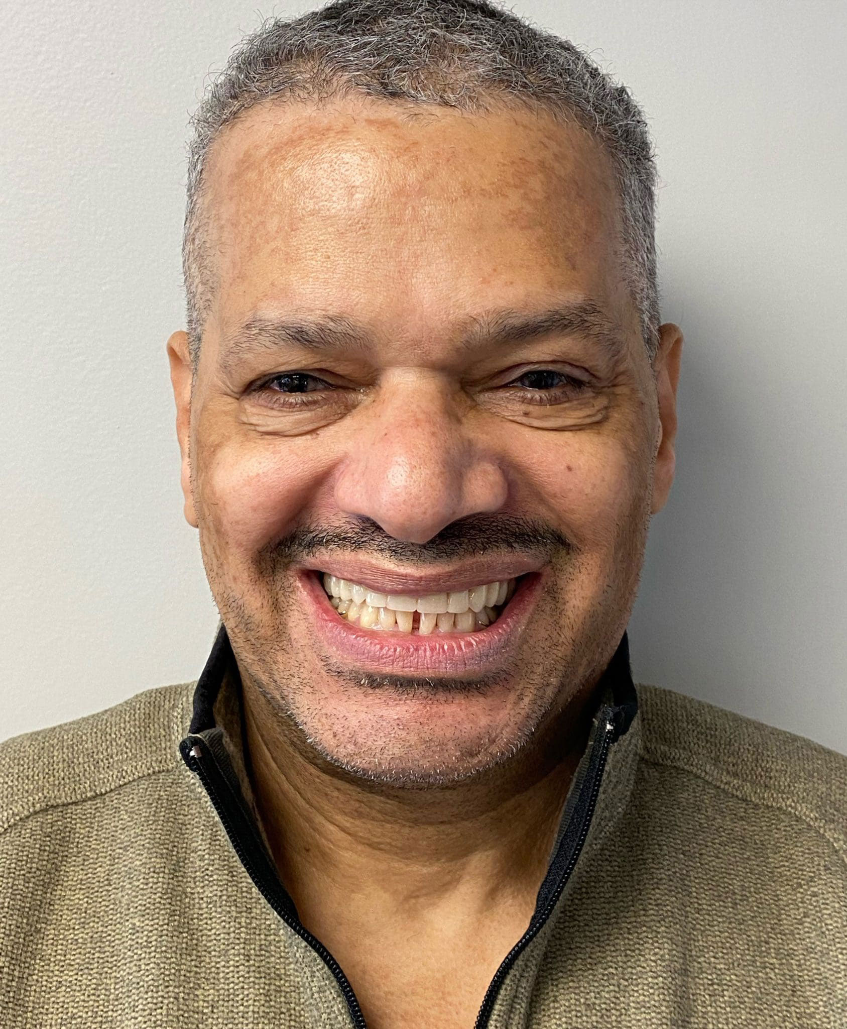 Natural denture smile